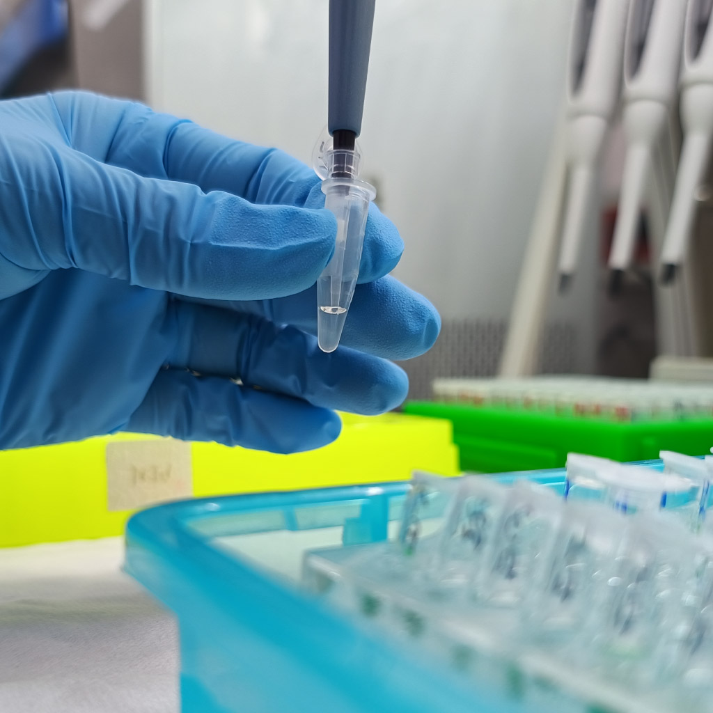 DIAP | Laboratorio PCR